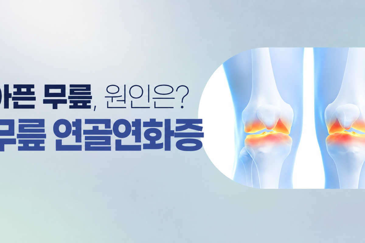 범계역 마취통증의학과 무릎 연골연화증, 계단 통증과 운동 관리 기준