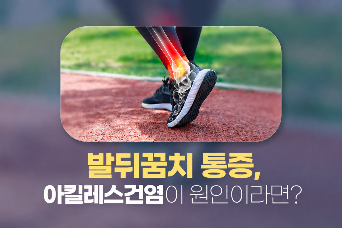 범계 아킬레스건염 통증, 발뒤꿈치 원인이라면?